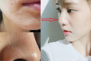 Cosmerx H.a Booster Serum